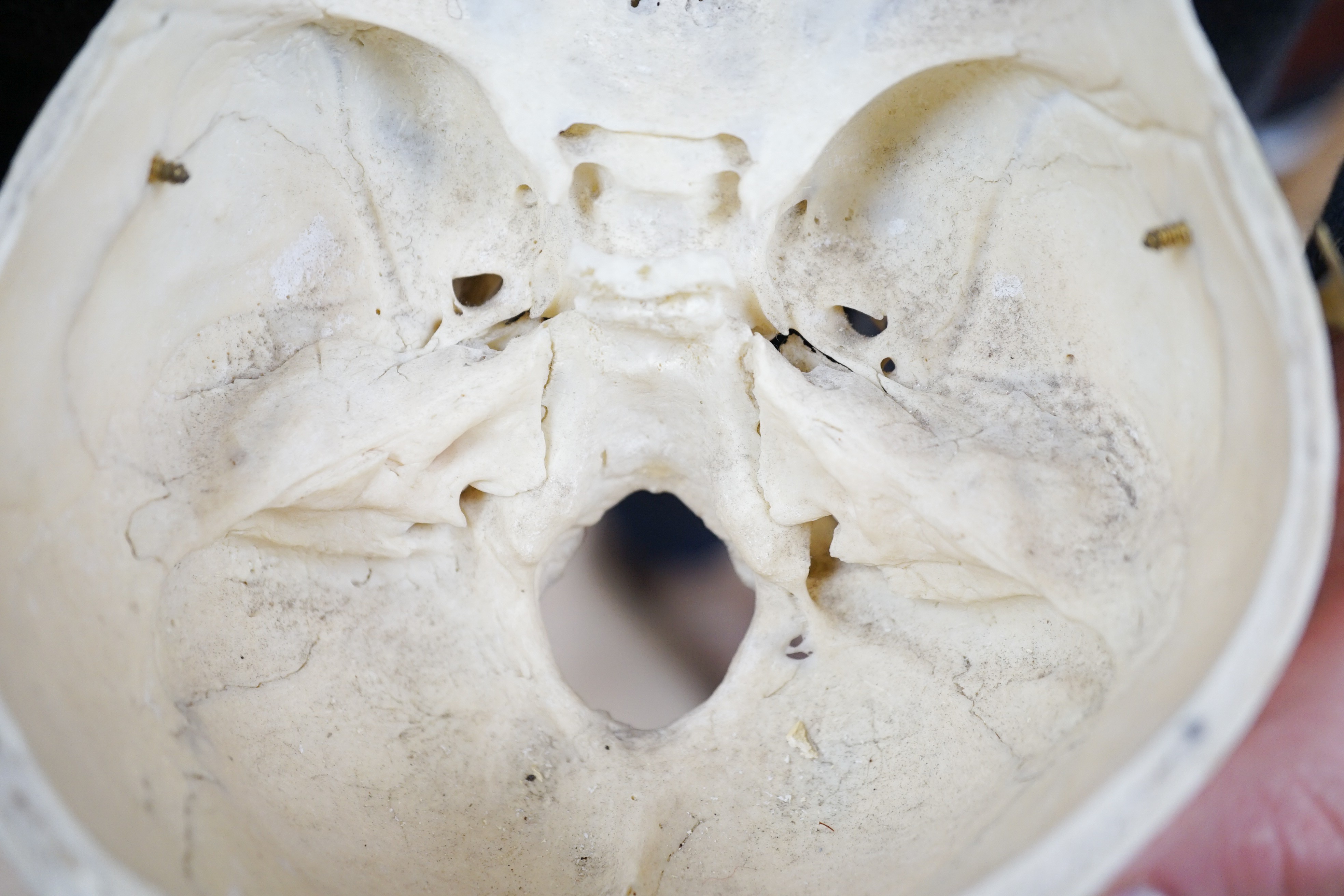 A human skull with removable cranium and spring loaded jaw 15.5cm